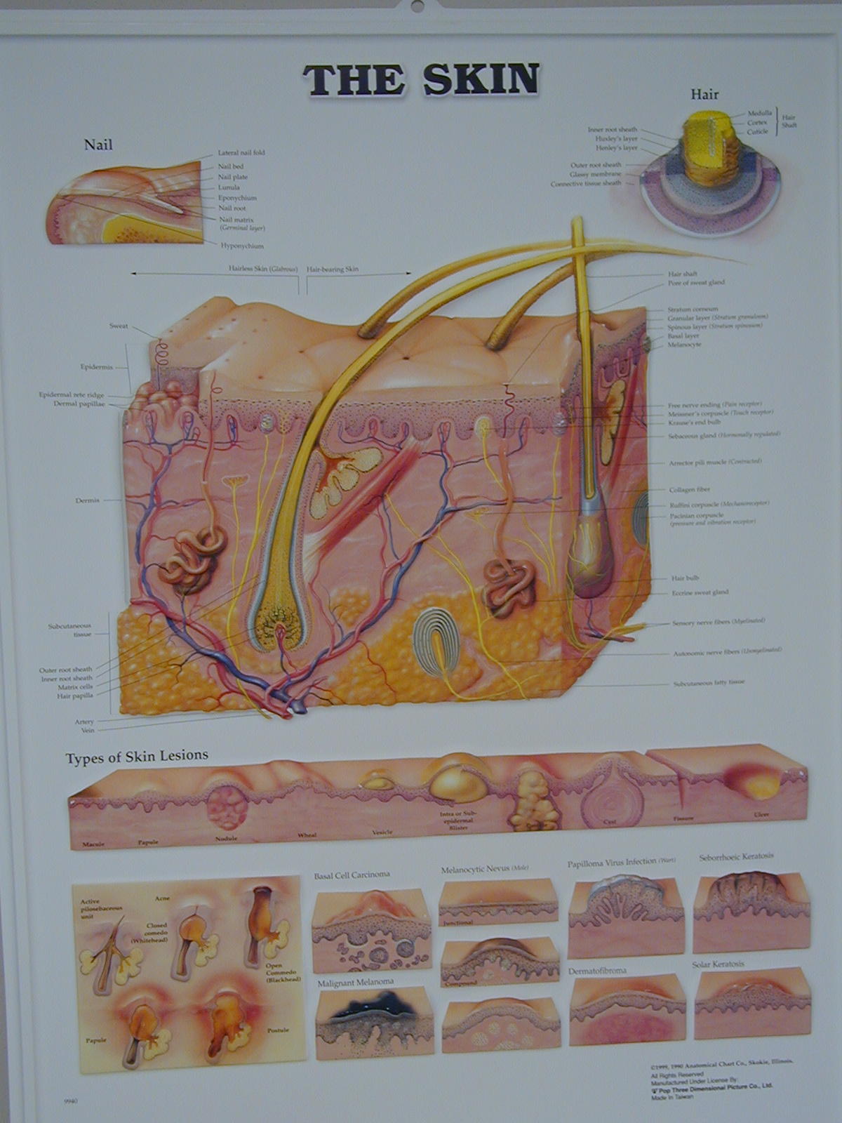 Bracelet Problem Skin Skin Integumentary System Concept Map